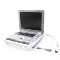 CONTEC handheld human Color Doppler Ultrasonic Diagnostic System digital ultrasound machine CMS1700A